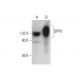 DPPX Antibody (H-4) - Western Blotting - Image 309536 