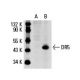 DR5 (B-D37): sc-65314. Western blot analysis of DR5 expression in... 