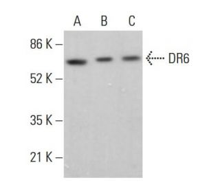 DR6 Antibody (E-4) - Western Blotting - Image 381943Each CRISPR/Cas9 Knockout (KO) Plasmid product consists of a pool of 3 plasmids designed to ensure identification and cleavage of a specific gene for maximum knockout efficiency. Each plasmid encodes a unique 20 nt sequence derived from the GeCKO (v2) library. 