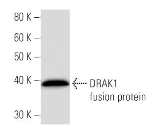 DRAK1 Antibody (3064C6a) - Western Blotting - Image 16883 
