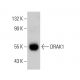 DRAK1 Antibody (3064C6a) - Western Blotting - Image 385140