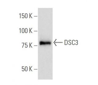 DSC3 Antibody (93-71) - Western Blotting - Image 33459 