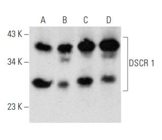 DSCR 1 Antibody (G-2) - Western Blotting - Image 356992 