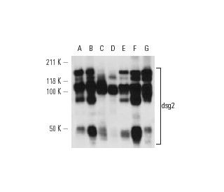 dsg2 Antibody (6D8) - Western Blotting - Image 12579 