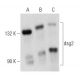 dsg2 Antibody (6D8) - Western Blotting - Image 356933 