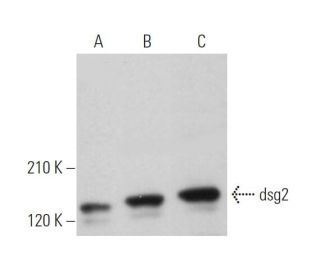 dsg2 Antibody (AH12.2) - Western Blotting - Image 373485 