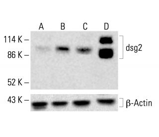 dsg2 Antibody (AH12.2) - Western Blotting - Image 412694