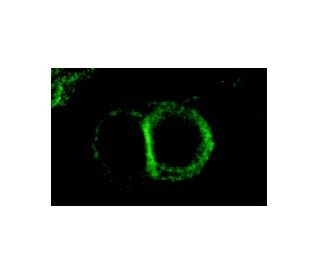 dsg3 Antibody (5H10) - Immunofluorescence - Image 7654 