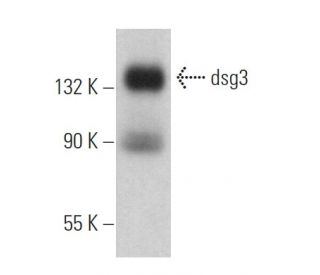 dsg3 Antibody (3G133) - Western Blotting - Image 367089Each CRISPR/Cas9 Knockout (KO) Plasmid product consists of a pool of 3 plasmids designed to ensure identification and cleavage of a specific gene for maximum knockout efficiency. Each plasmid encodes a unique 20 nt sequence derived from the GeCKO (v2) library.