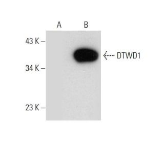 DTWD1 Antibody (E-5) - Western Blotting - Image 304354