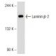 Laminin β-2 (D-16): sc-23412. Western blot analysis of Laminin β-2 expression in DU 145 whole cell lysate.