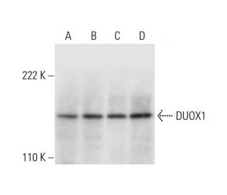 DUOX1 Antibody (H-9) - Western Blotting - Image 292069SAM Transcription Activation: SAM system utilizing dCas9-VP64, MS2-P65-HSF1, and sgRNA for precise gene transcription activation.