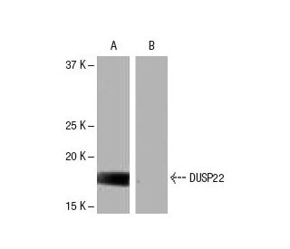 DUSP22 Antibody (9J2) - Western Blotting - Image 65095Each CRISPR/Cas9 Knockout (KO) Plasmid product consists of a pool of 3 plasmids designed to ensure identification and cleavage of a specific gene for maximum knockout efficiency. Each plasmid encodes a unique 20 nt sequence derived from the GeCKO (v2) library. 