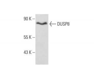 DUSP8 Antibody (B-9) - Western Blotting - Image 131233The Double Nickase Plasmid features a U6 promoter for sgRNA expression, a 20 nt targeting sequence, and a gRNA scaffold to guide Cas9n. It includes a CBh promoter for Cas9n (D10A) and puromycin resistance, GFP for transfection verification, and nuclear localization signals (NLS). The 2A peptide allows co-expression of Cas9n and Puro from a single promoter, enabling precise genome editing with reduced off-target effects. 