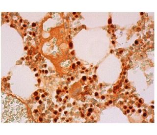 dUTPase Antibody (G-6) - Immunohistochemistry - Image 312086 