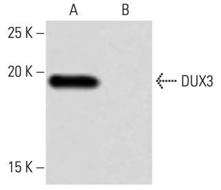 DUX3 Antibody (6L8) - Western Blotting - Image 64918