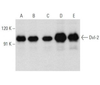 Dvl-2/Dishevelled 2/DVL2 Antibody (D-6) - Western Blotting - Image 358400