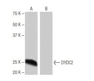 DYDC2 Antibody (9H8) - Western Blotting - Image 64919