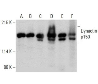 Dynactin p150 Antibody (12) - Western Blotting - Image 387338 