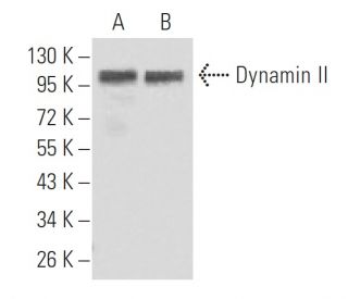 Dynamin II Antibody (5E4C2F3) - Western Blotting - Image 137431