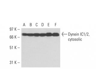 Dynein IC1/2, cytosolic Antibody (2Q46) - Western Blotting - Image 17476 