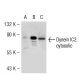Dynein IC1/2, cytosolic Antibody (C-2) - Western Blotting - Image 54165 