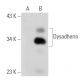 Dysadherin Antibody (D-2) - Western Blotting - Image 108885