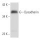 Dysadherin Antibody (D-2) - Western Blotting - Image 356906 