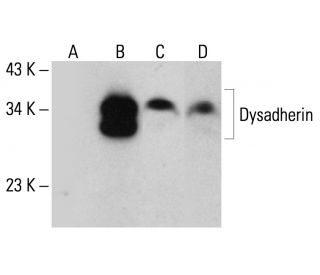 Dysadherin Antibody (E-12) - Western Blotting - Image 344502