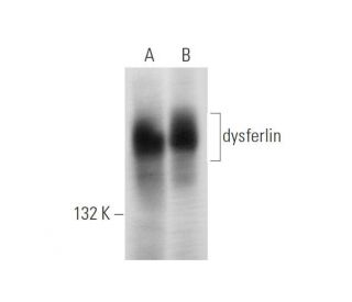 dysferlin Antibody (C-11) - Western Blotting - Image 309470