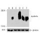 dysferlin 抗体 (C-11): sc-398905。Western blot 分析未处理 HeLa (A)、化学处理 HeLa (B)、未处理 HCT-116 (C) 及化学处理 HCT-116 (D, E, F) 细胞裂解液中 dysferlin 的表达。检测试剂:m-IgG3 BP-HRP:sc-533670。β-肌动蛋白(C4):sc-47778用作加载对照。检测试剂:m-IgG Fc BP-HRP:sc-525409。 dysferlin Antibody (C-11) - Western Blotting - Image 415574