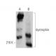 dystrophin Antibody (3B7) - Western Blotting - Image 361089