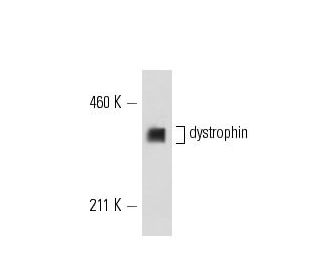 dystrophin Antibody (7A10) - Western Blotting - Image 12615 