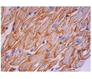dystrophin Antibody (MANDRA1) - Immunohistochemistry - Image 290458 