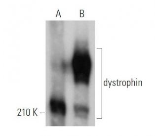 dystrophin Antibody (MANDYS8) - Western Blotting - Image 361083 