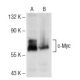 Western blot analysis of c-Myc expression in untreated (A) and (E)-4-Hydroxyhexenal (sc-202593) treated (B) Jurkat whole c