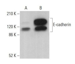 E-cadherin Antibody (1.B.54) - Western Blotting - Image 379641 