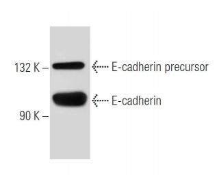 E-cadherin Antibody (5F133) - Western Blotting - Image 38456