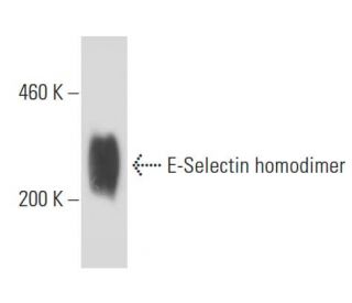 E-Selectin/CD62E/SELE Antibody (UZ5) - Western Blotting - Image 15589