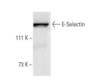 E-Selectin/CD62E/SELE Antibody (CTB202) - Western Blotting - Image 5269