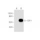 E2F1 Antibody (E-2) - Western Blotting - Image 57610