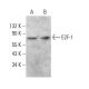 E2F1 Antibody (E-2) - Western Blotting - Image 380013 