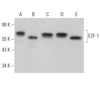 E2F1 Antibody (KH129) - Western Blotting - Image 379403 