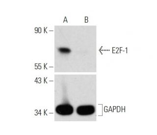 E2F-1 CRISPR/Cas9 KO Plasmid (h): sc-400123. Western blot analysis of human E2F-1 expression in Control CRISPR/Cas9 Plasmi 
