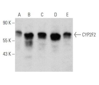 E2F-3 Antibody (0.N.263) - Western Blotting - Image 354804 