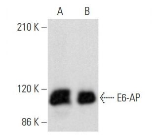 E6-AP Antibody (F-1) - Western Blotting - Image 354951 