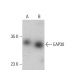 EAP30 Antibody (G-8) - Western Blotting - Image 387341 