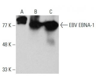 EBV EBNA-1 Antibody (1EB12) - Western Blotting - Image 384021 