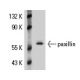 ECV304 Cell Lysate: sc-2269. Western blot analysis of paxillin expression...