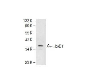 ECV304 Cell Lysate: sc-2269. Western blot analysis of HoxD1 expression... 